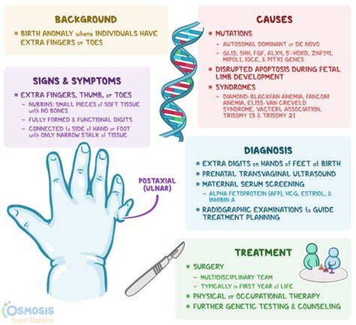 Is having an extra finger genetic?